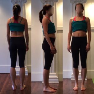 prolapse story, www.coresetfitness.com, hypopressive ftiness