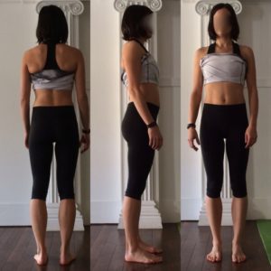 prolapse story, www.coresetfitness.com, hypopressive ftiness