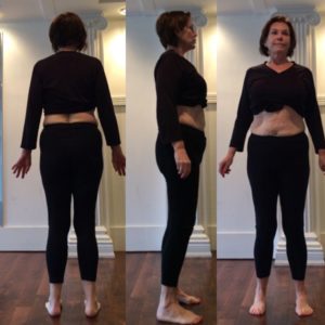 prolapse story, www.coresetfitness.com, hypopressive ftiness